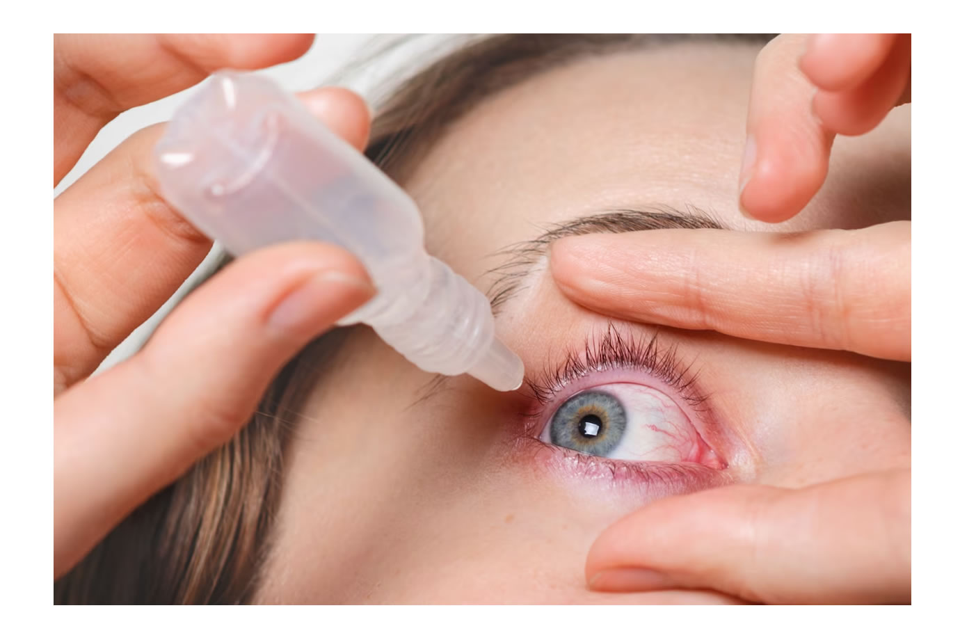 Learn what conjunctivitis is and how to treat it